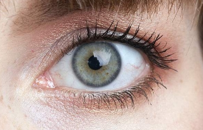 深圳哪個醫(yī)院的顴骨降低整形效果？2023年度排名前十大整形醫(yī)院點評！