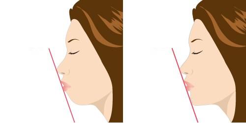 2023鄭州哪家口碑不錯的切開填充去痘疤整形美容醫(yī)院排行榜發(fā)布，前10強揭曉！