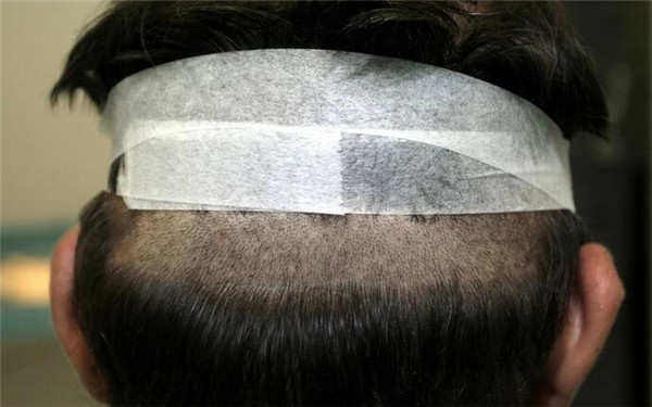 重慶哪家醫(yī)院豐唇口碑好？2023年榜單前十大整形美容醫(yī)院推薦！