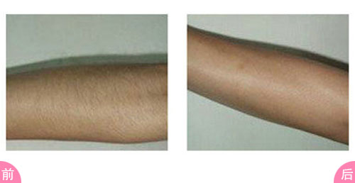 2023蘇州祛頸紋哪家醫(yī)院好？口碑比較好的10所整形醫(yī)院更新！