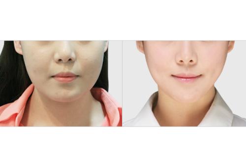 2023久負(fù)盛名的四川地區(qū)疤痕修復(fù)醫(yī)院排行榜TOP10！