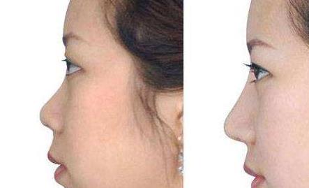 太原哪家醫(yī)院專業(yè)斑點(diǎn)祛老，口碑比較好？2023太原斑點(diǎn)祛老美容醫(yī)院排名TOP10熱門機(jī)構(gòu)推薦！