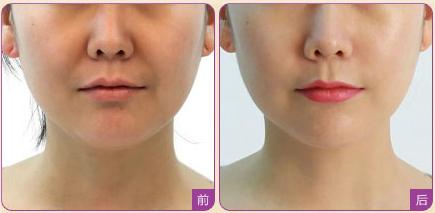 上海眉間紋醫(yī)療整形醫(yī)院強榜前10，選取眉間紋正規(guī)醫(yī)院指南