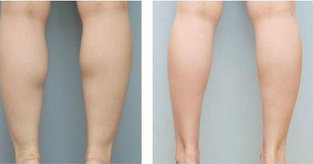 2023年天津韓妃開眼角手術(shù)醫(yī)院排名及性價比推薦！整形美容行業(yè)的權(quán)威榜單揭曉