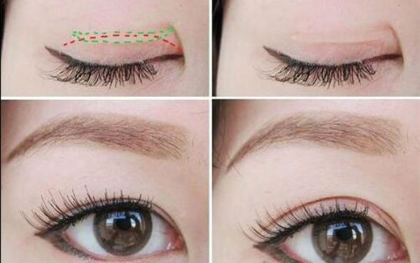 2023連云港眼底紋皺紋整形私立醫(yī)院排名榜單！治療效果很好！