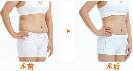 合肥鼻翼鼻頭縮小的醫(yī)療機構(gòu)，性價比高的有哪些？合肥2023年前10名醫(yī)療整形醫(yī)院詳盡概況！