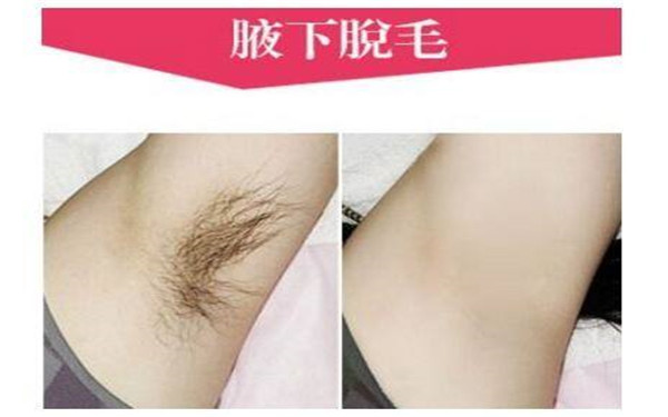 南通哪家醫(yī)院的微針祛除木偶紋技術(shù)好？2023年排行評價極高的南通整形美容醫(yī)院！