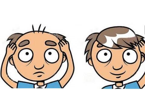 2023株洲眼紋肉毒素注射榜單揭曉！排名TOP10的正規(guī)醫(yī)院值得信賴！