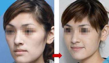 廈門注射膠原蛋白減少川字紋的整形醫(yī)院排名公開！2023廈門膠原蛋白去皺醫(yī)院前10強(qiáng)榜單揭曉！