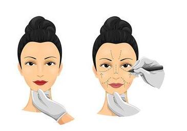 福建哪家整形醫(yī)院專業(yè)除眼皺紋效果好？2023年福建除眼皺紋評(píng)分十強(qiáng)醫(yī)院公布！