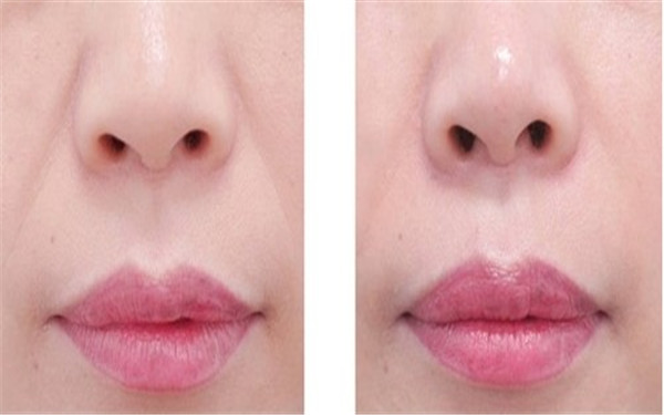 揭秘2023年海南十大專業(yè)除眼紋醫(yī)療美容醫(yī)院，哪些值得考慮！