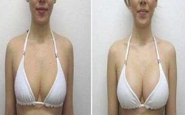 2023太原水光針去除色素沉重醫(yī)院TOP10，看看這些行之有效的整容美容醫(yī)院！