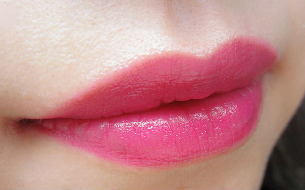 2023上海很受歡迎的射頻吸脂瘦肩部整形醫(yī)院排行榜公布！看看哪些醫(yī)院值得選擇