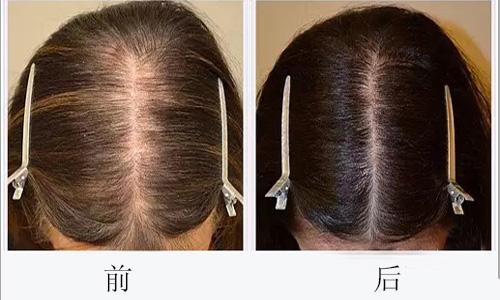 廣州哪些醫(yī)院可靠，專業(yè)進行臉部疤痕切除整形美容？2023年十大排名公開！