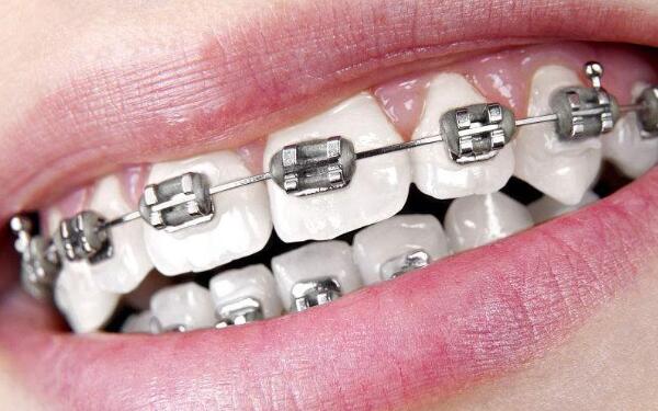 2023年北京微晶祛雀斑美容醫(yī)院排名前十，哪幾家值得去？