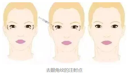 2023年北京鼻端缺損整形美容醫(yī)院前十強排名揭曉！知名度爆棚的醫(yī)療機構(gòu)盤點！