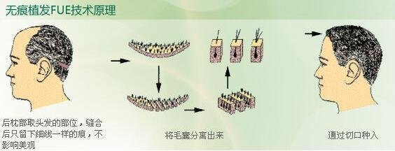 2023青島眼袋修復手術排名前10的信譽醫(yī)院！