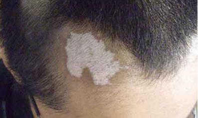 南寧哪家醫(yī)院除皺效果好？2023年排名前10強(qiáng)的正規(guī)醫(yī)院盤(pán)點(diǎn)！