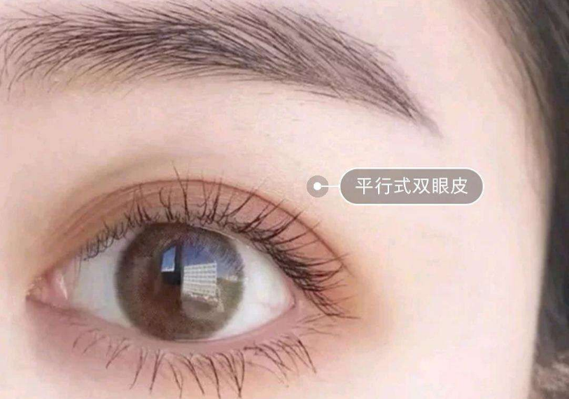 鄭州最受推崇的雙眼皮整形專家推薦榜單露臉！多位實力經(jīng)驗高手霸占榜首！