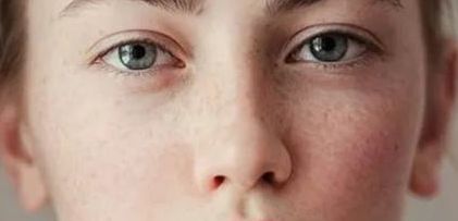 上海鼻小柱成形術整形醫(yī)院排名及手術費用2025全新指南！