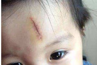 四川胸部下垂矯正專業(yè)私立三甲醫(yī)院介紹！精選前五排名出爐，獨(dú)家剖析其醫(yī)療實(shí)力與特色