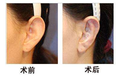 北京下垂隆胸醫(yī)院top5排行榜單發(fā)布（2025年最新版）