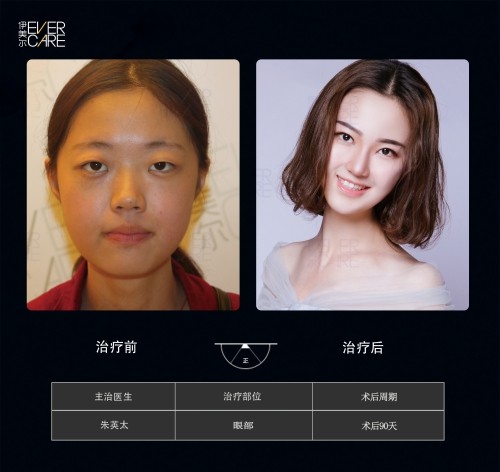 阿爾法9°美眼，打開視界，美無止境