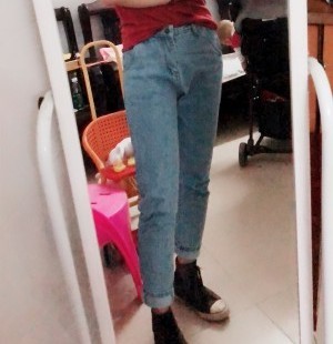 胖腿女孩兒福利分享：吸脂瘦大腿的蛻變，效果值得點贊！