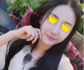 深圳鵬愛做隆鼻手術兩個月效果 深圳鵬愛做隆鼻手術兩個月效果