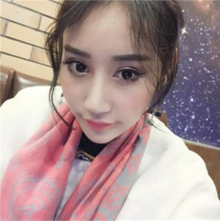 雙眼皮失敗丑的不敢見(jiàn)人，昆明麗都整形雙眼皮修復(fù)案例分享