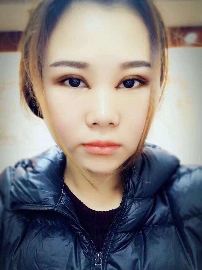 汕頭曙光雙眼皮一周正面 汕頭曙光雙眼皮一周正面