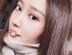 北京彤美耳軟骨隆鼻案例分享術后一個月效果 北京彤美耳軟骨隆鼻案例分享術后一個月效果