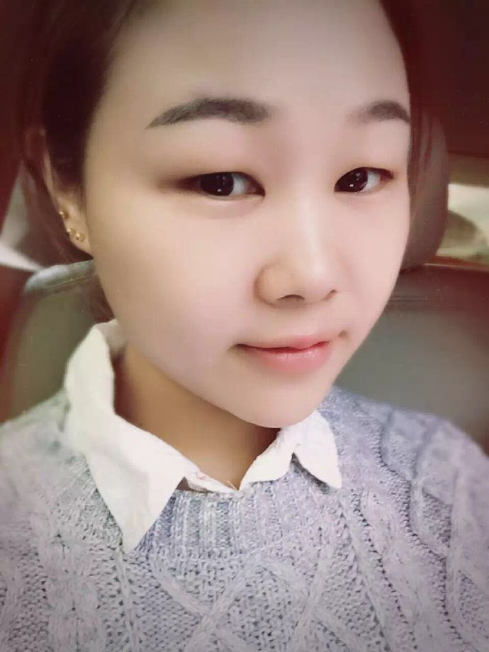 汕頭曙光雙眼皮術(shù)前效果 汕頭曙光雙眼皮術(shù)前效果