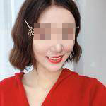 杭州國雅口腔隱形矯正案例結(jié)束 杭州國雅口腔隱形矯正案例結(jié)束