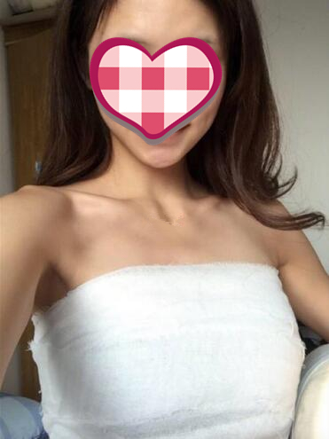 濟(jì)南美爾雅整形自體脂肪隆胸術(shù)后第二天 濟(jì)南美爾雅整形自體脂肪隆胸術(shù)后第二天