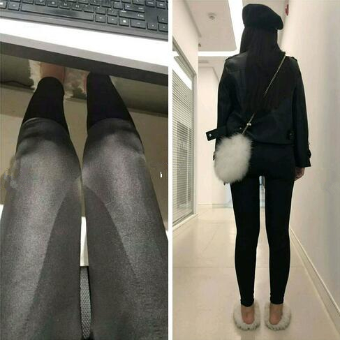 4800做的大腿吸脂，效果竟然還不錯(cuò)