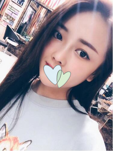 廈門海峽整形鼻綜合案例術(shù)后兩個(gè)月 廈門海峽整形鼻綜合案例術(shù)后兩個(gè)月