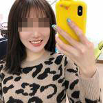 杭州國雅口腔隱形矯正案例一年 杭州國雅口腔隱形矯正案例一年