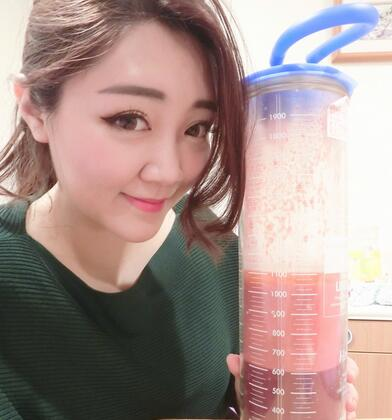 揭陽美萊整形手臂吸脂案例分享，輕松告別拜拜肉