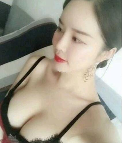 濟(jì)南海峽整形假體隆胸術(shù)后一個(gè)月 濟(jì)南海峽整形假體隆胸術(shù)后一個(gè)月