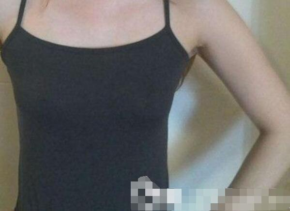 吉安第二醫(yī)院妙桃假體隆胸案例，我一女的都賊喜歡