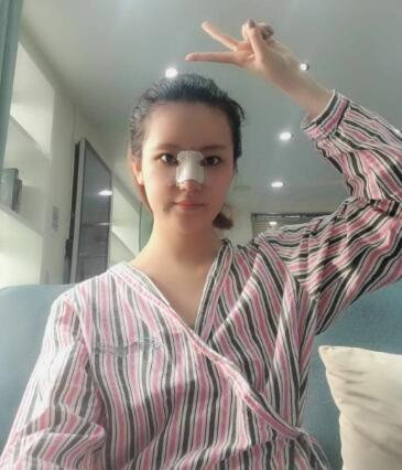 北京葉子整形肋軟骨隆鼻案例反饋，這鼻子是真實(shí)存在的嗎