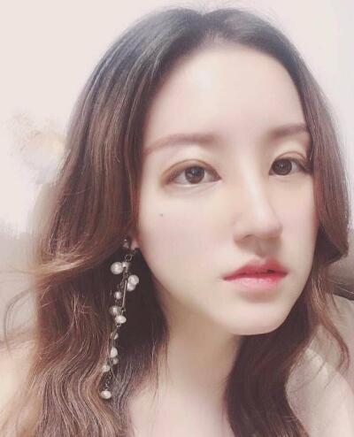 北京葉子整形肋軟骨隆鼻案例術(shù)后一個(gè)月 北京葉子整形肋軟骨隆鼻案例術(shù)后一個(gè)月