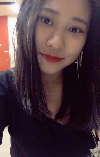 肇慶華美整形切開雙眼皮術(shù)后三個(gè)月效果分享，這不比貼雙眼皮香？