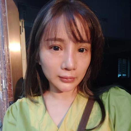 天津文怡整形水光針注射前 天津文怡整形水光針注射前