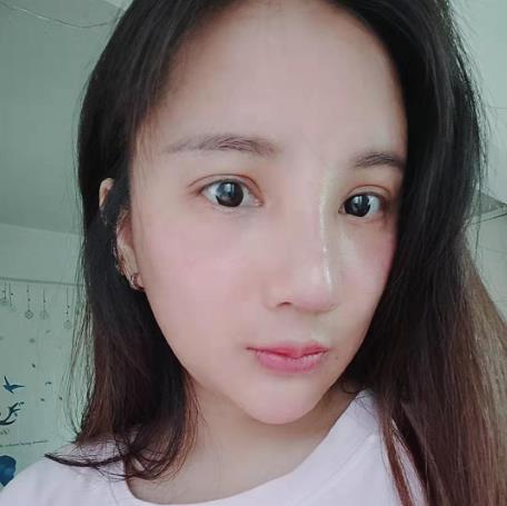 天津文怡整形水光針注射一個(gè)月 天津文怡整形水光針注射一個(gè)月