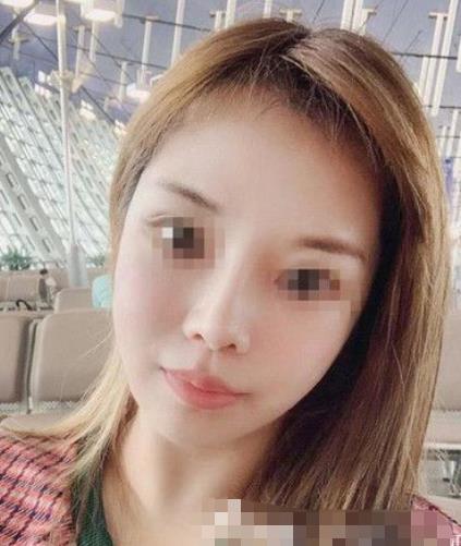 南京閱顏整形瘦臉針注射后半個(gè)月 南京閱顏整形瘦臉針注射后半個(gè)月