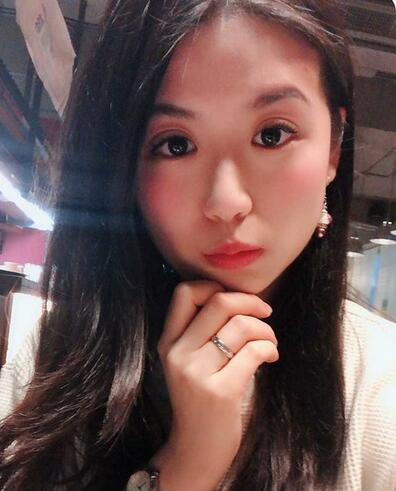 汕頭曙光整形皮秒激光祛斑一個月效果反饋，斑沒了