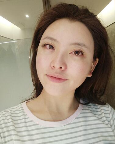 上海首爾麗格樸興植下頜角整形一個(gè)月