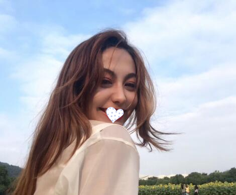 徐州時(shí)光洪揚(yáng)整形雙眼皮術(shù)后兩個(gè)月效果 徐州時(shí)光洪揚(yáng)整形雙眼皮術(shù)后兩個(gè)月效果